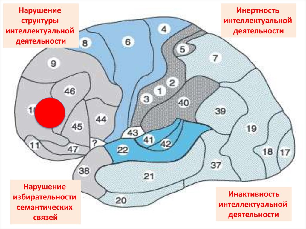 Презентация нарушения мышления при локальных поражениях мозга