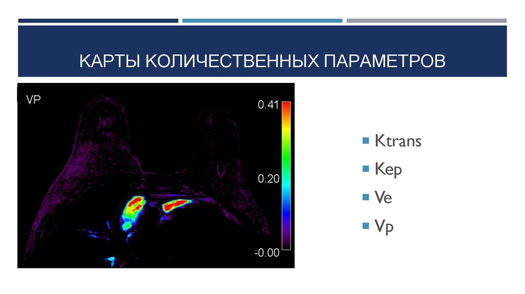 Магнитные железы