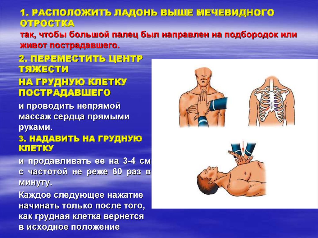 Первая медицинская помощь при остановке сердца презентация онлайн 1020