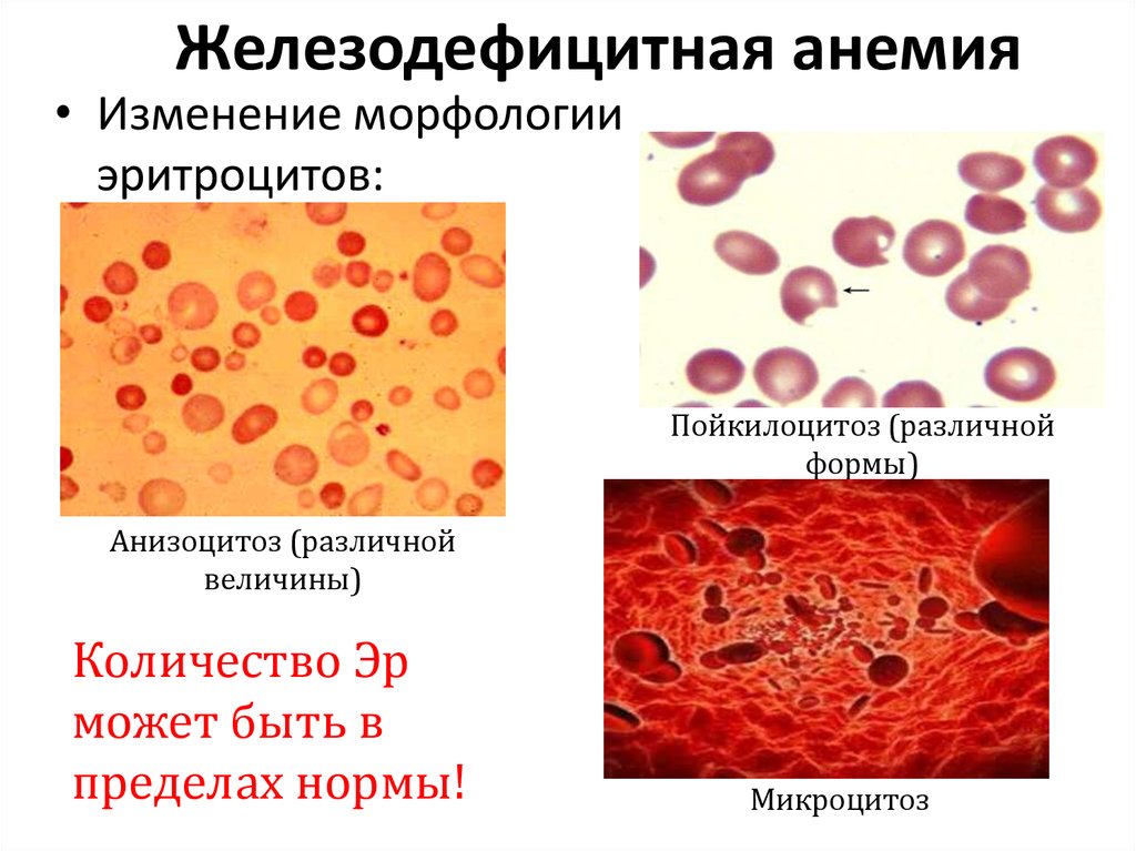 Клиническая картина анемий