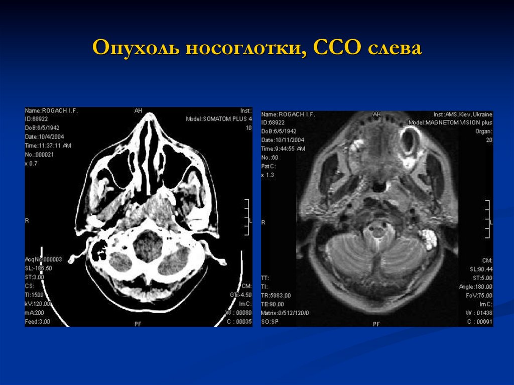 Картина объемного образования