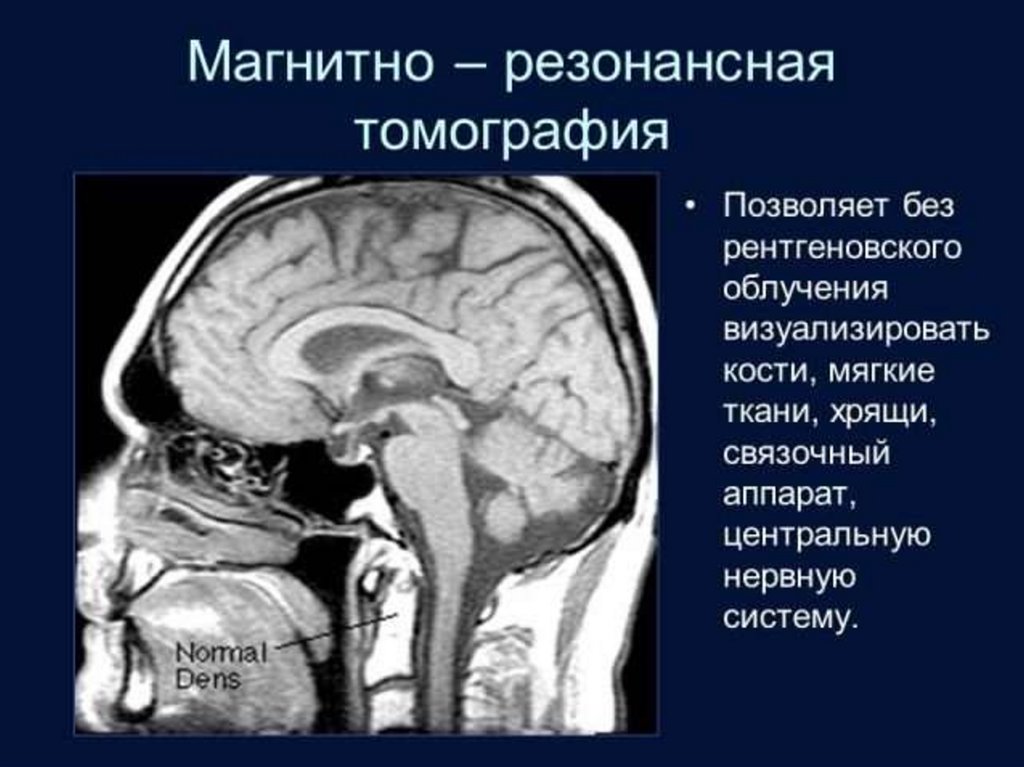 Лучевая диагностика нервной системы презентация