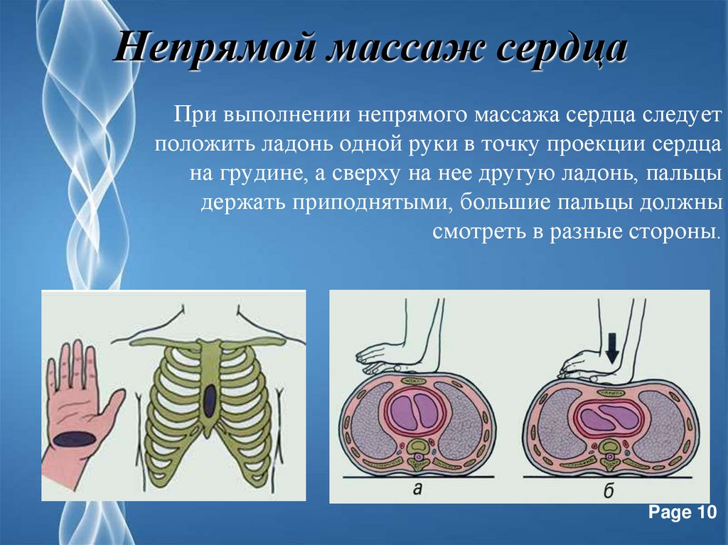 Непрямой сердца. Пе прямой массаж сердца. Закрытый массаж сердца. Непрямой массаж сердца презентация. При проведении наружного массажа сердца ладони следует.