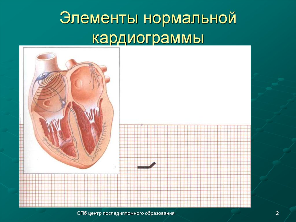Элементы нормальной кардиограммы
