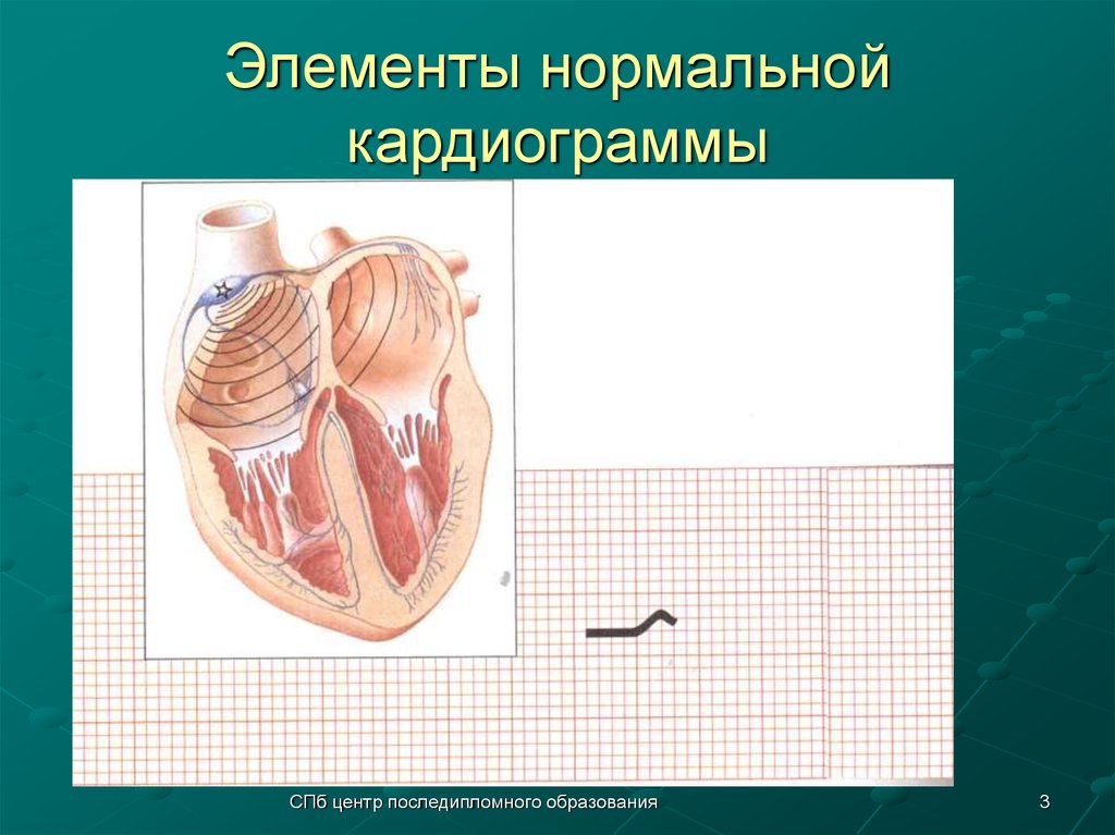 Элементы нормальной кардиограммы