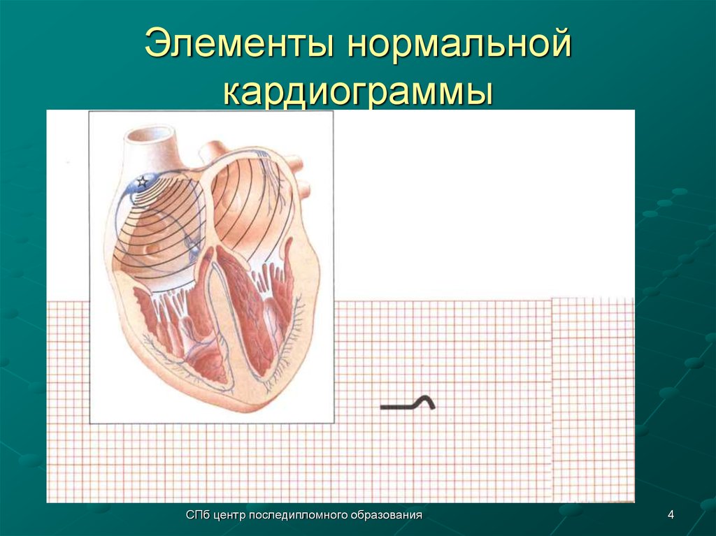 Элементы нормальной кардиограммы