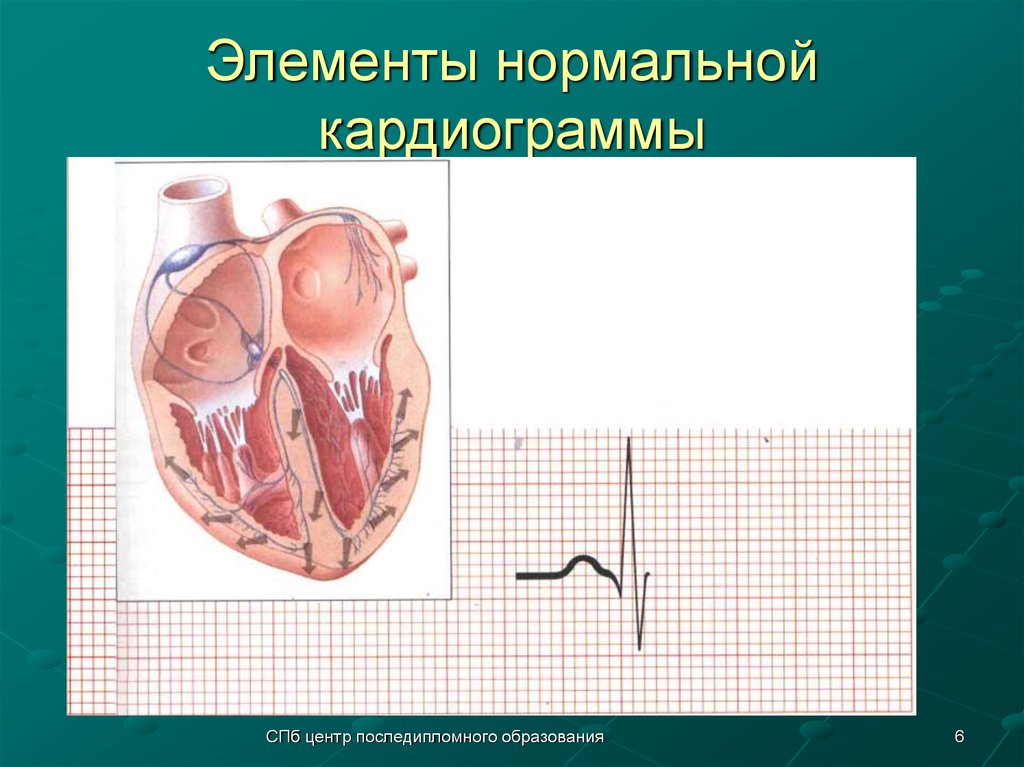 Элементы нормальной кардиограммы