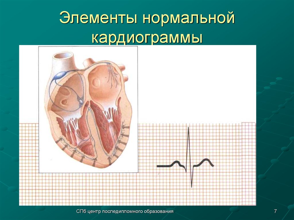 Элементы нормальной кардиограммы