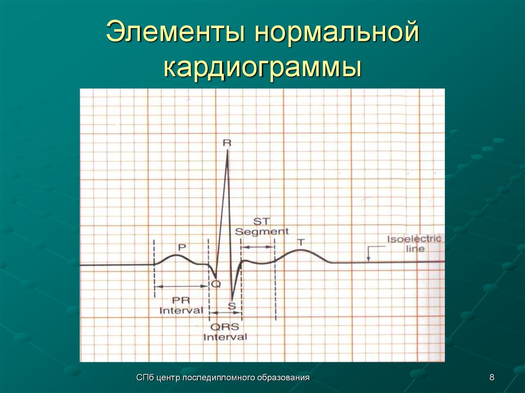 Нарисовать нормальную гепатограмму