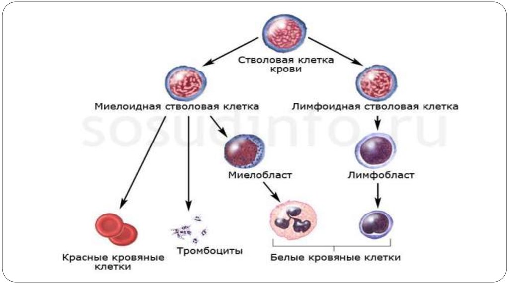 Лейкоз патофизиология презентация