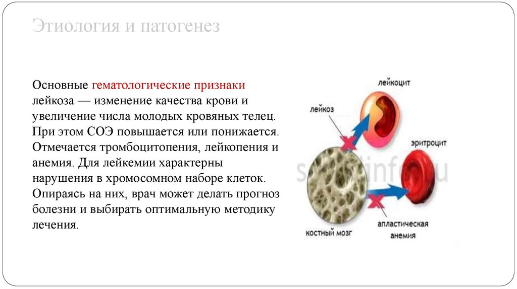 Патогенез хронического лимфолейкоза схема