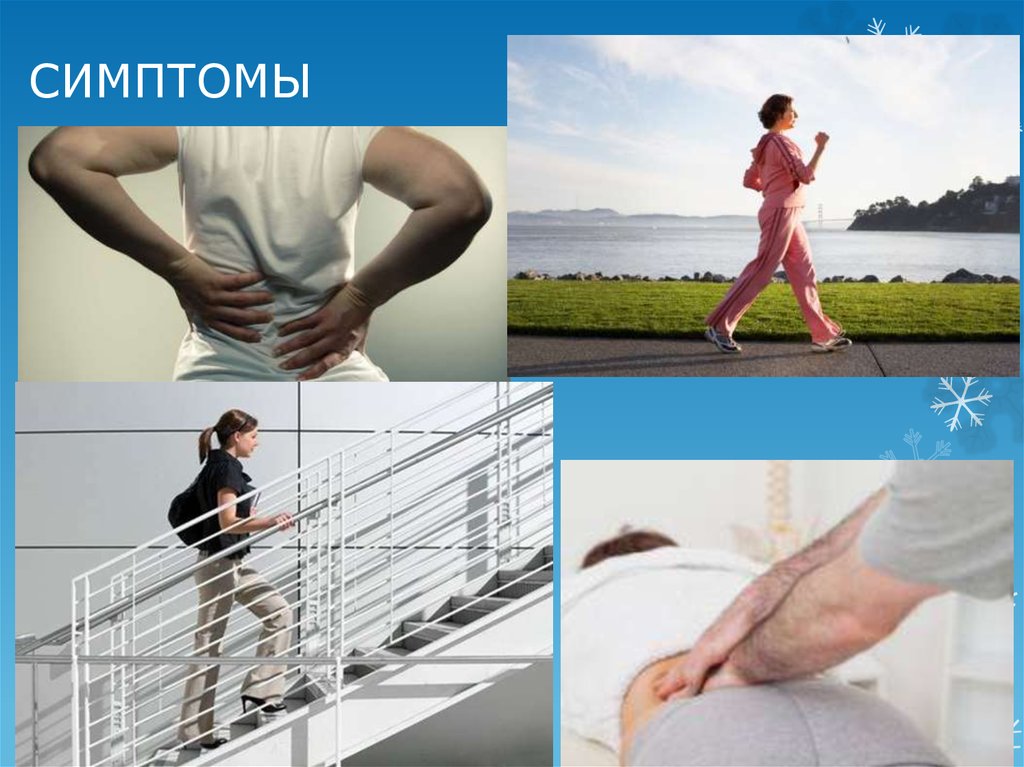 Сакроилеит. Факторы - презентация онлайн