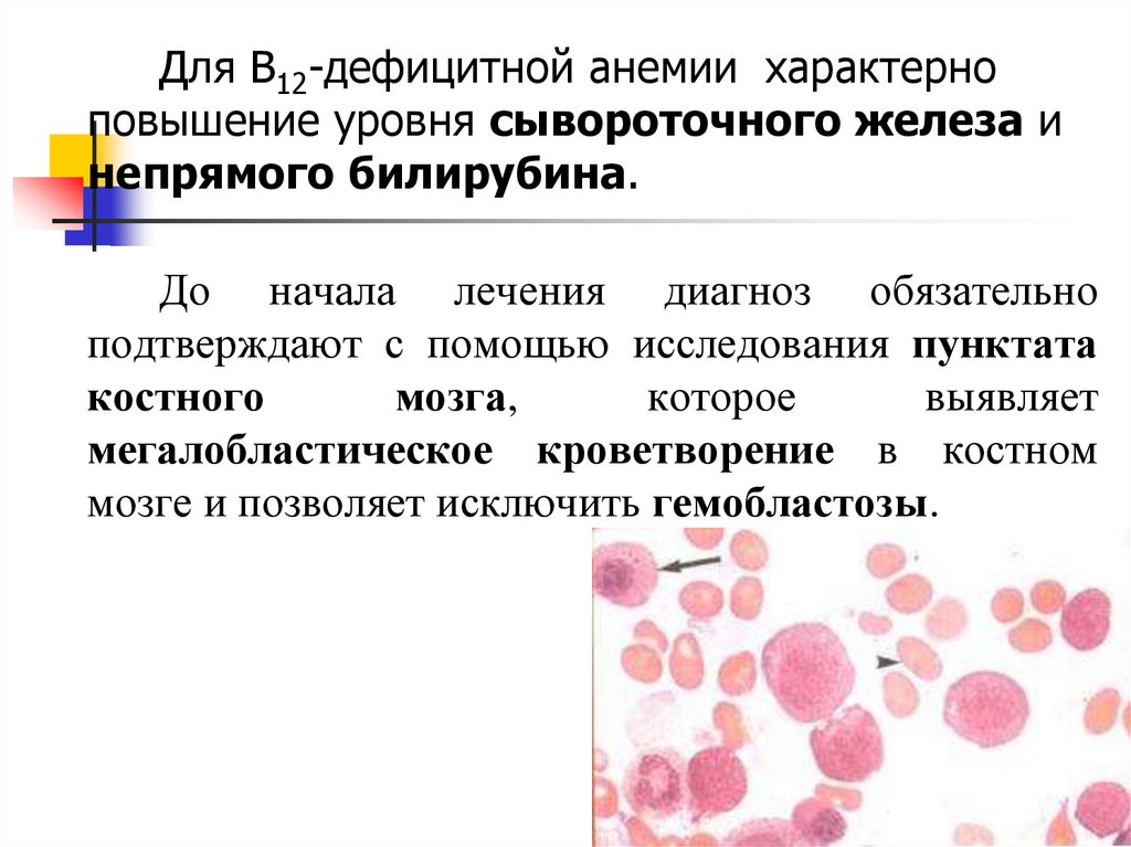 Картина крови при в12 и фолиеводефицитной анемии