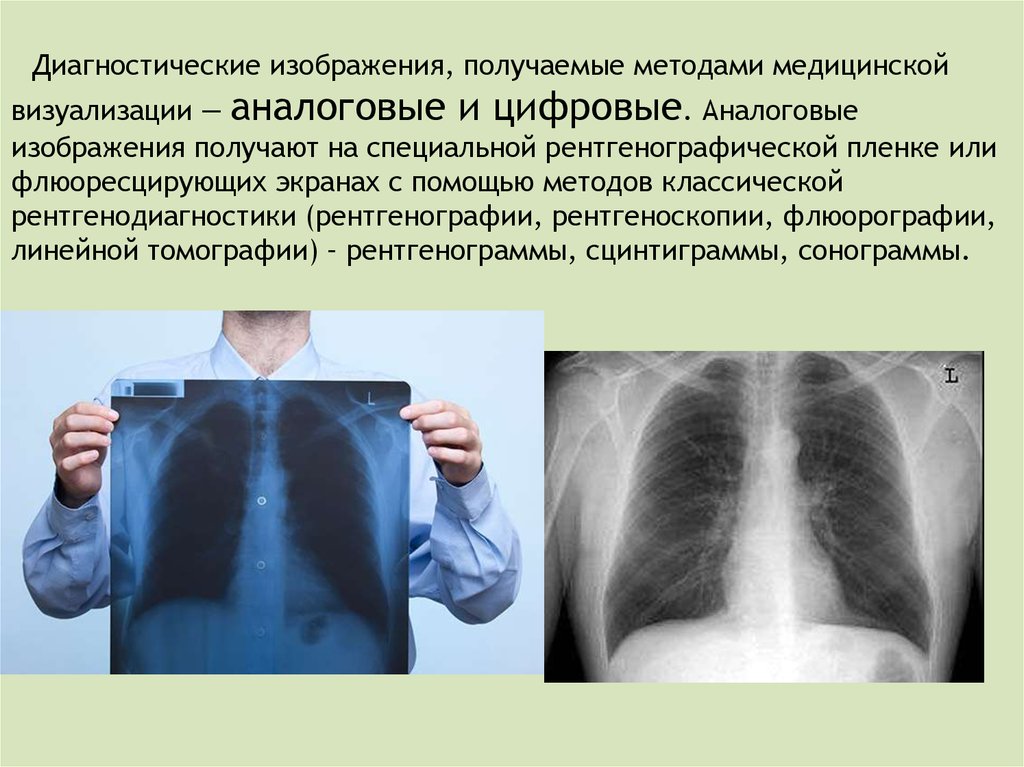 Рентгеновские методы изображения. Аналоговое изображение в лучевой диагностике. Аналоговый и цифровой рентген. Аналоговые изображения в медицине. Аналоговая и цифровая рентгенография.