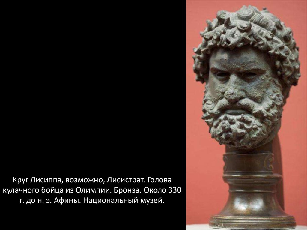 Круг Лисиппа, возможно, Лисистрат. Голова кулачного бойца из Олимпии. Бронза. Около 330 г. до н. э. Афины. Национальный музей.