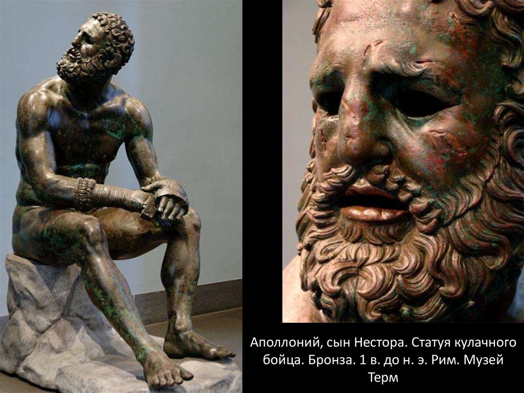 Аполлоний, сын Нестора. Статуя кулачного бойца. Бронза. 1 в. до н. э. Рим. Музей Терм