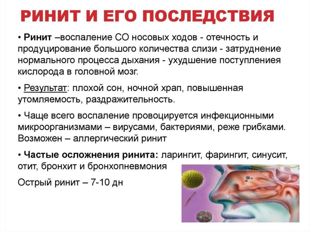 Презентация на тему ринит