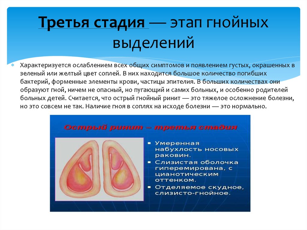 Презентация на тему ринит