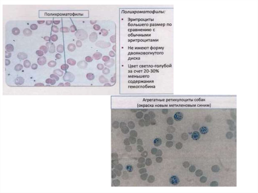 Ретикулоциты это. Методика подсчета ретикулоцитов. Окраска на ретикулоциты методика. Ретикулоциты гематологический. Ретикулоциты микропрепарат.