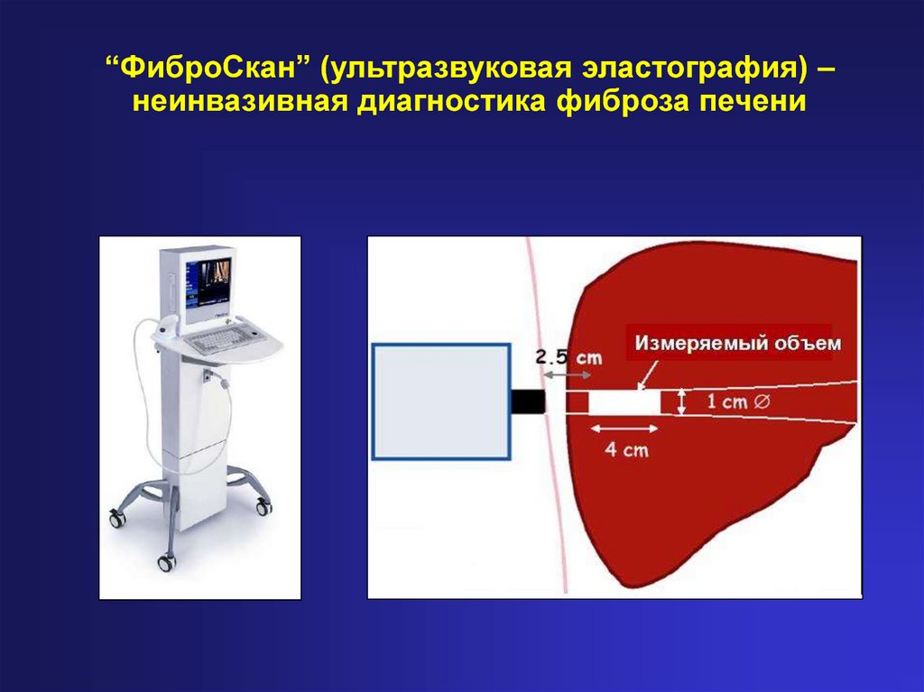 Эластометрия это