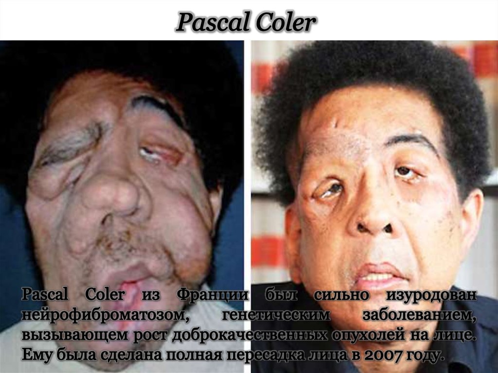 Pascal Coler