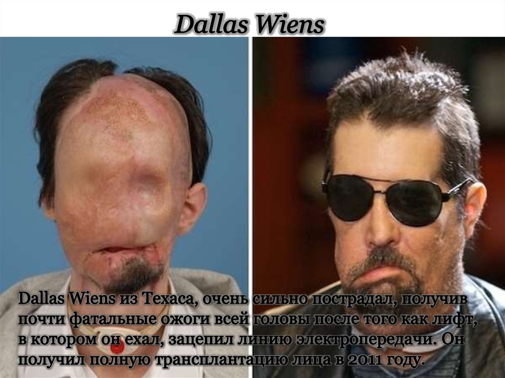 Dallas Wiens