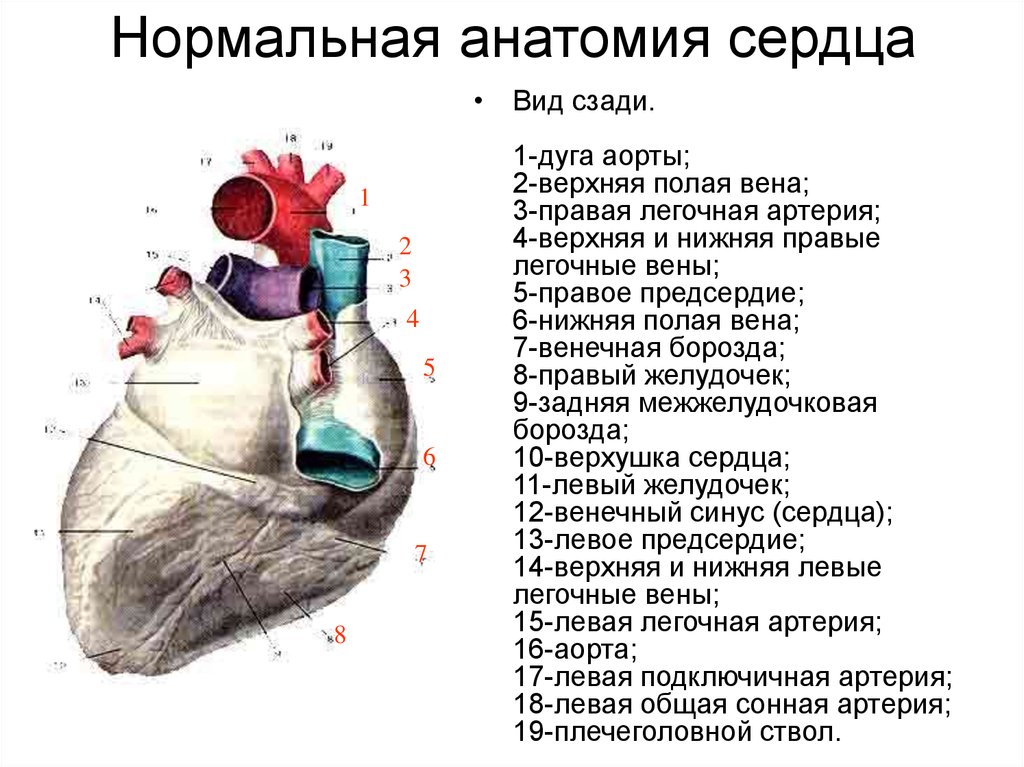 Венозное сердце. Венечная борозда сердца анатомия. Верхняя и нижняя полые вены у сердца анатомия. Нормальная анатомия сердца. Задняя межжелудочковая борозда сердца.