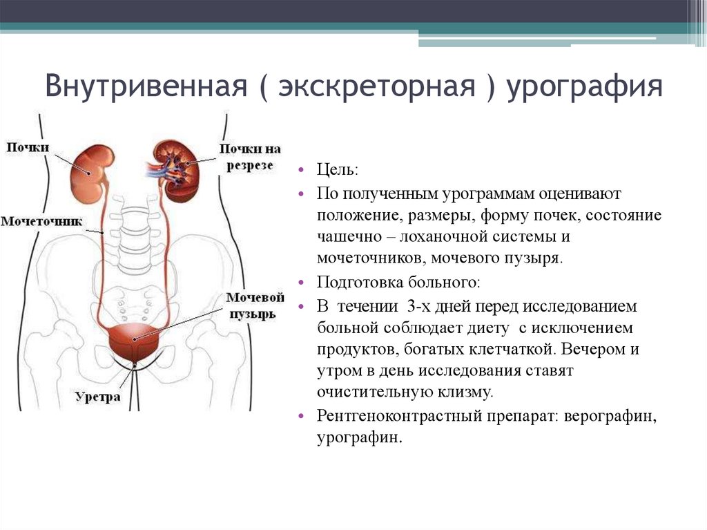 Исследование почек подготовка. Подготовка к внутривенной урографии почек. Подготовка к экскреторной урографии почек алгоритм. Подготовка пациента к урографии почек. Подготовка пациента к экскреторной урографии почек.