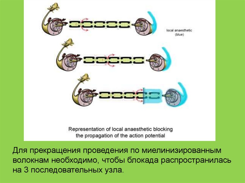 Местные анестетики презентация