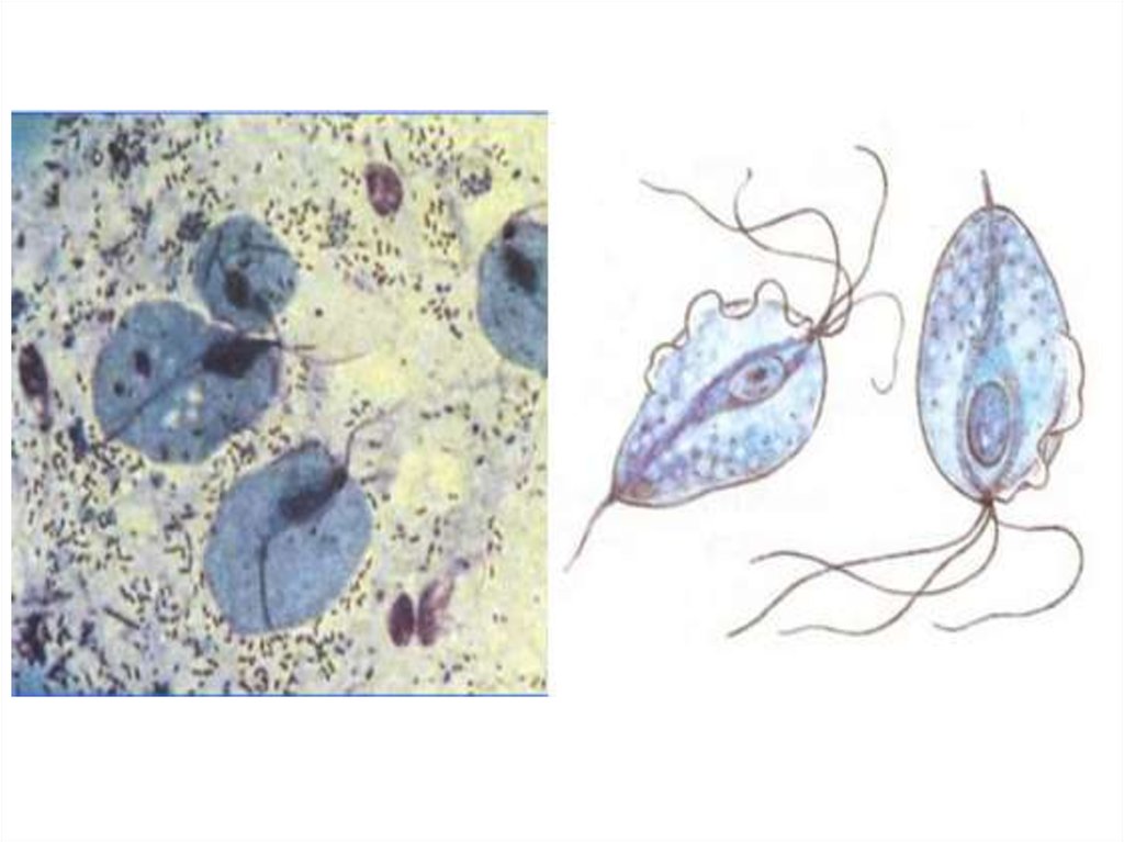 Трихомониаз возбудитель