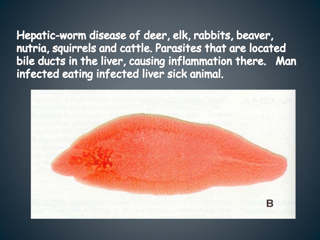 Hepatic-worm disease of deer, elk, rabbits, beaver, nutria, squirrels and cattle. Parasites that are located bile ducts in the
