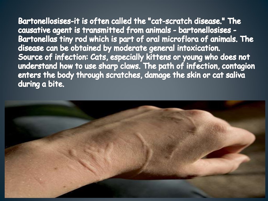 Bartonellosises-it is often called the "cat-scratch disease." The causative agent is transmitted from animals - bartonellosises