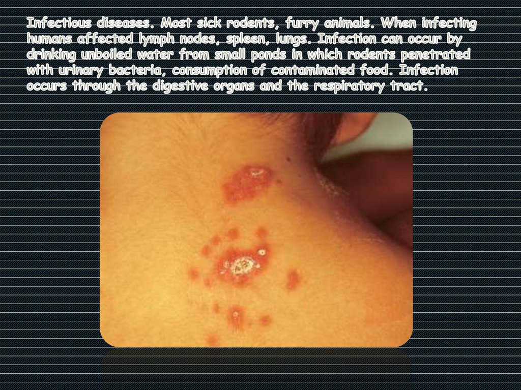 Infectious diseases. Most sick rodents, furry animals. When infecting humans affected lymph nodes, spleen, lungs. Infection can