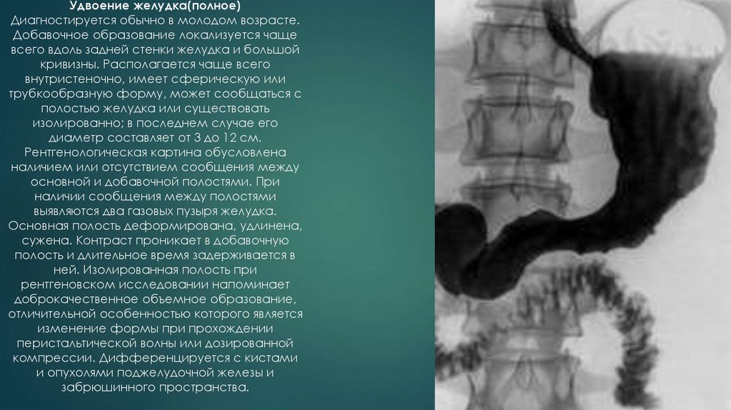 Рентгенография желудка презентация