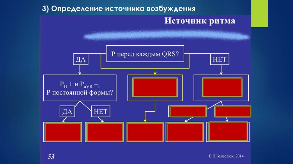 Определение источника возбуждения водителя ритма