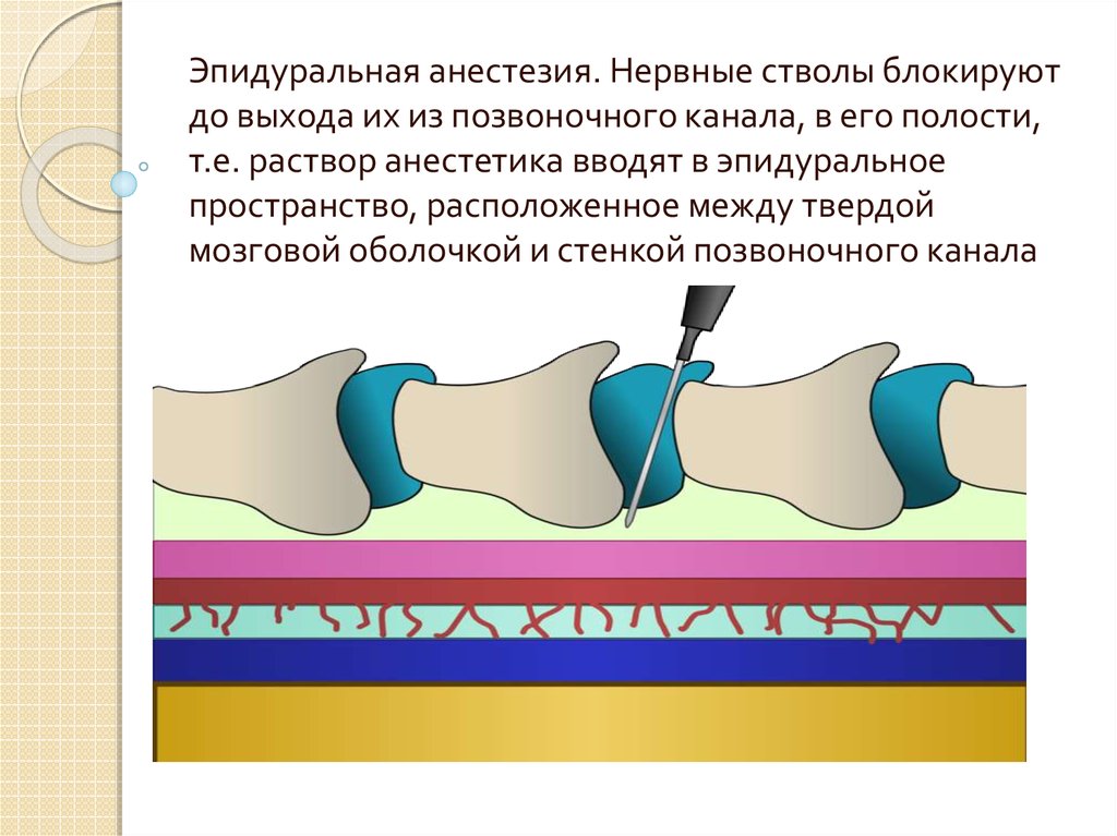 Регионарная анестезия презентация