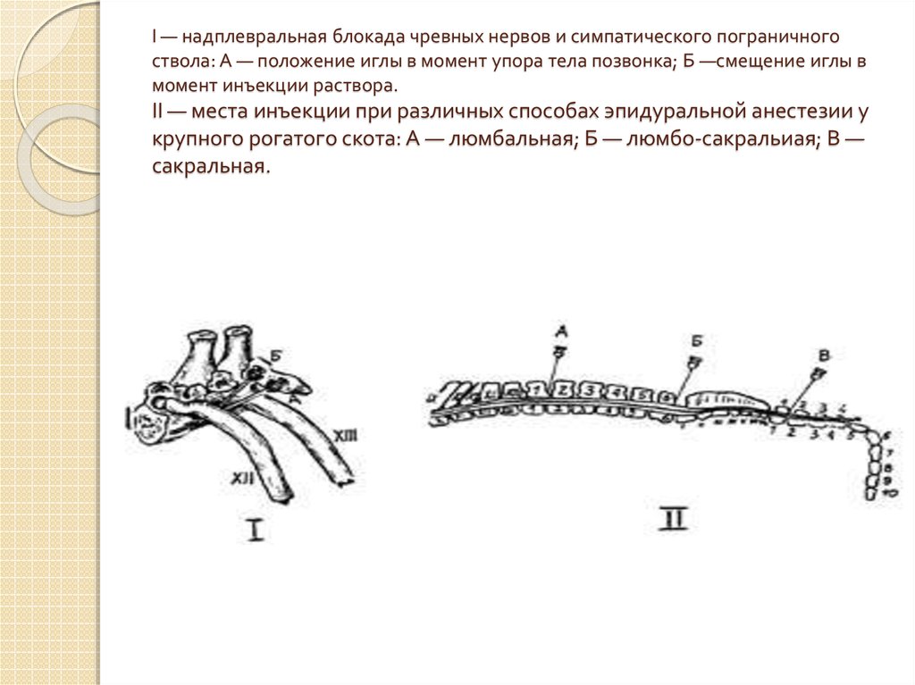 Анестезия по брауну