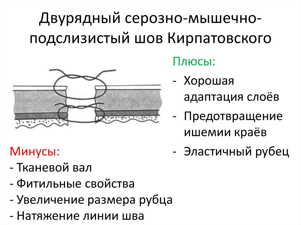 Кишечный шов презентация