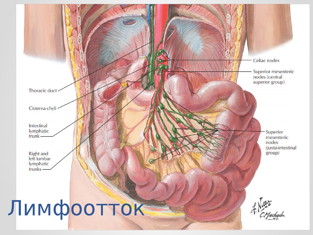 Узелки кишечника. Лимфоотток тонкой кишки. Лимфоотток от кишечника анатомия. Лимфоузлы тонкого кишечника.