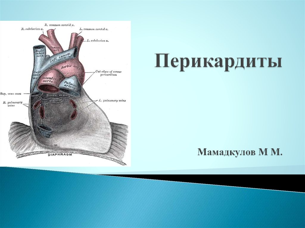 Острый перикардит презентация