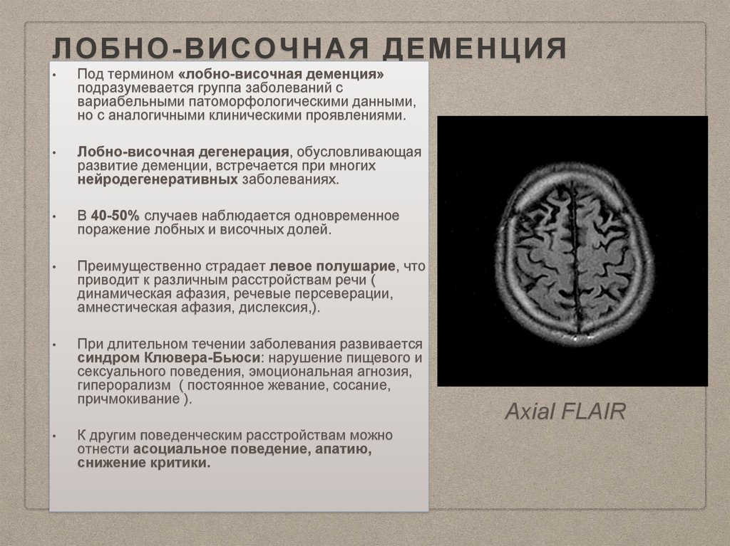 Лобная деменция. Лобно-височная деменция. Лобовисочнуя деменция. Лобно-височная деменция симптомы. Лобно-височная деменция у подростков.