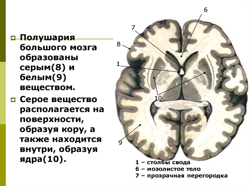 Ядра мозга образованный. Конечный мозг серое и белое вещество. Большие полушария головного мозга серое и белое вещество. Серое вещество в коре больших полушарий головного мозга:. Строение и функции белого вещества больших полушарий.
