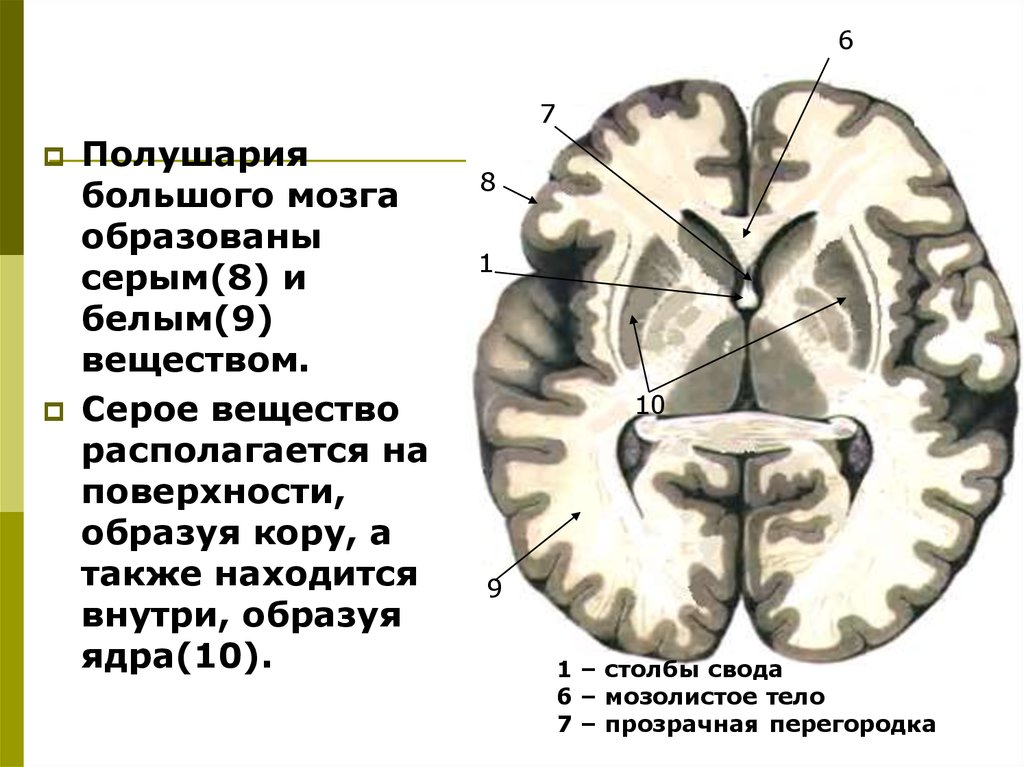 Белое вещество головного. Большие полушария головного мозга серое и белое вещество. Структуры серого вещества головного мозга. Строение и функции белого вещества больших полушарий. Срезы головного мозга большие полушария серое и белое вещество.