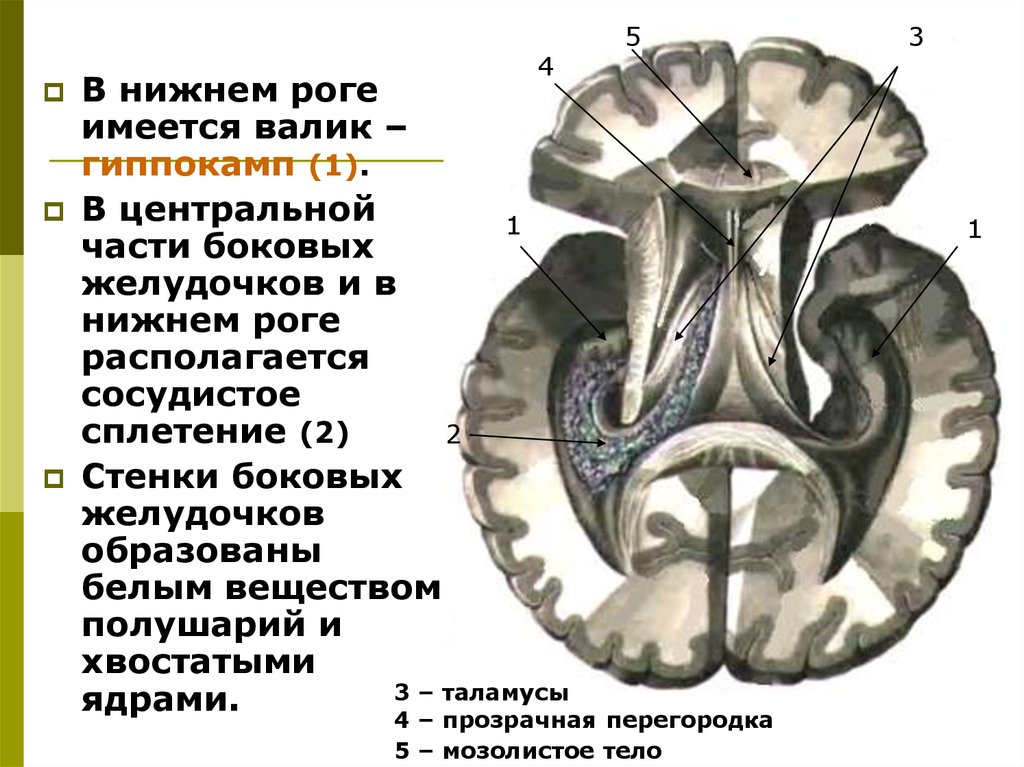 Стенка желудочка. Боковые желудочки мозга: стенки, сосудистые сплетения.. В Нижнем Роге бокового желудочка располагаются. Нижний Рог бокового желудочка. В Нижнем Роге бокового желудочка располагаются гиппокамп.