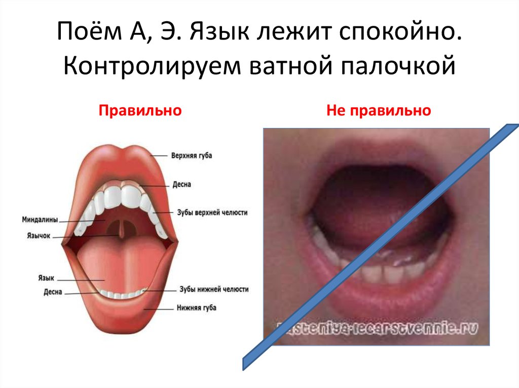 Расположенная на нижней