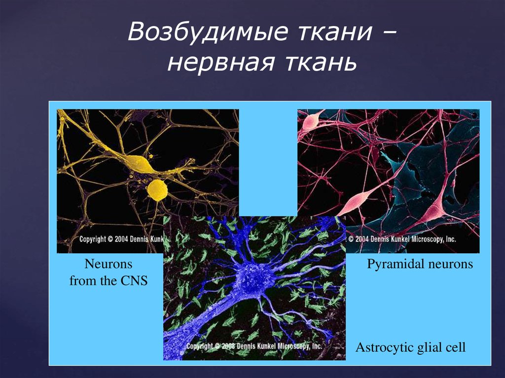 Нервная ткань. Расположение клеток нервной ткани. Местоположение клетки