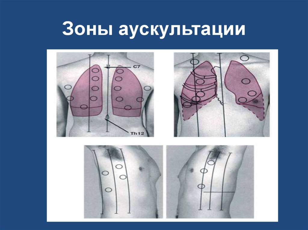 Аускультация легких презентация пропедевтика