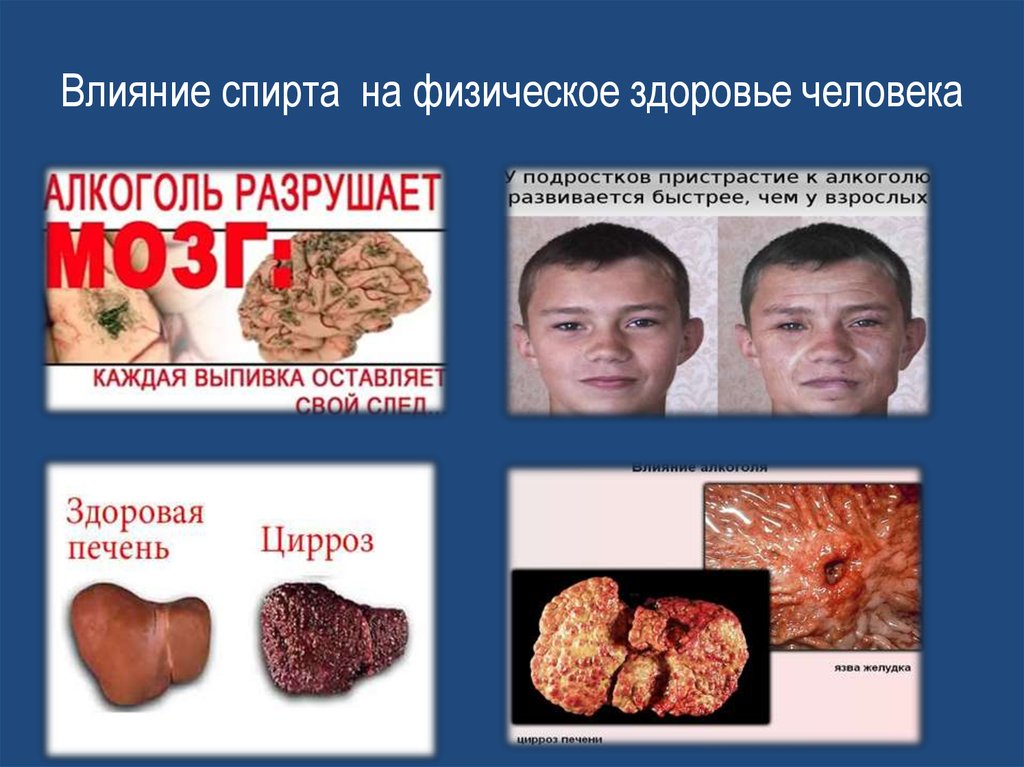 Влияние спирта на физическое здоровье человека
