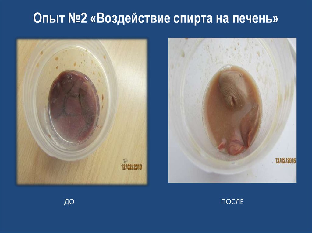 Опыт №2 «Воздействие спирта на печень»