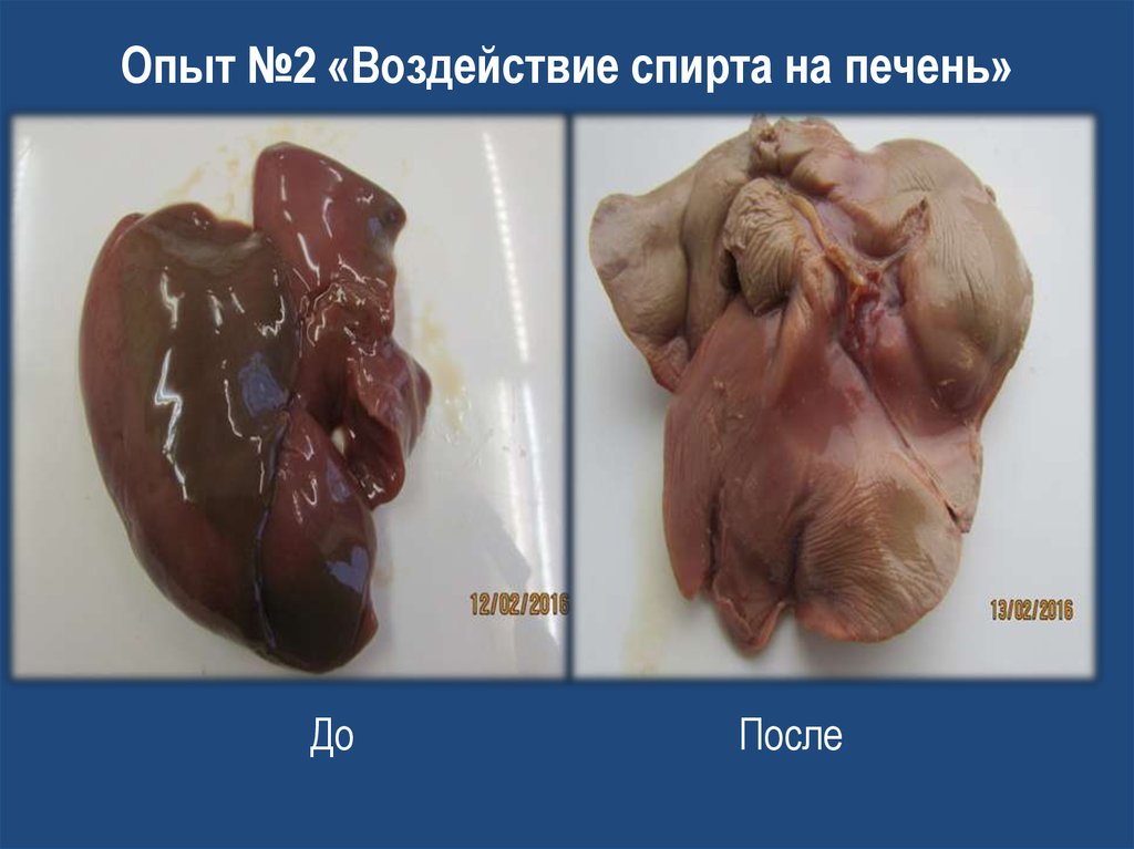 Опыт №2 «Воздействие спирта на печень»